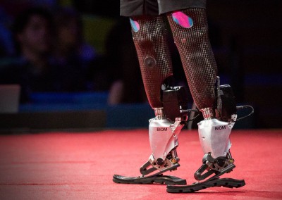 Bionics that let us run, climb and dance